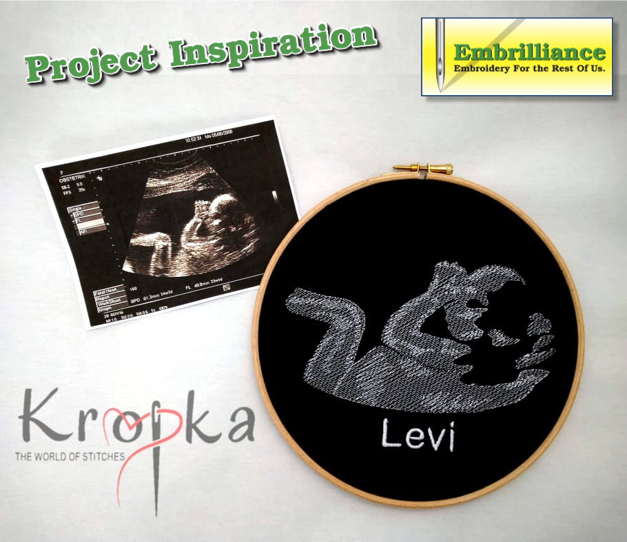 Digitized Ultrasound Photo